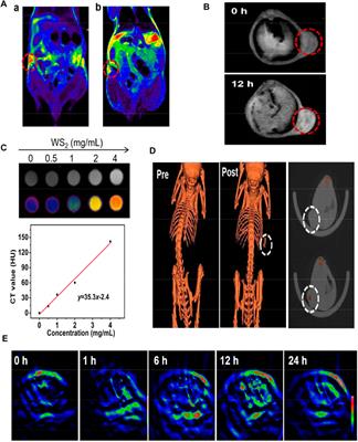 Recent Advances in Transition-Metal Based Nanomaterials for Noninvasive Oncology Thermal Ablation and Imaging Diagnosis